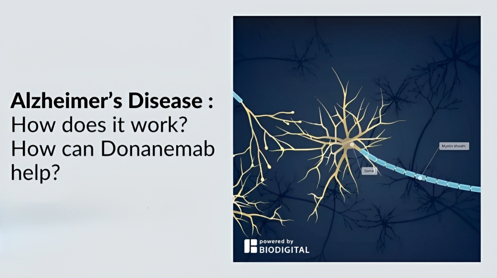 A New Drug For Alzheimer's Disease “donanemab” - IAS GYAN