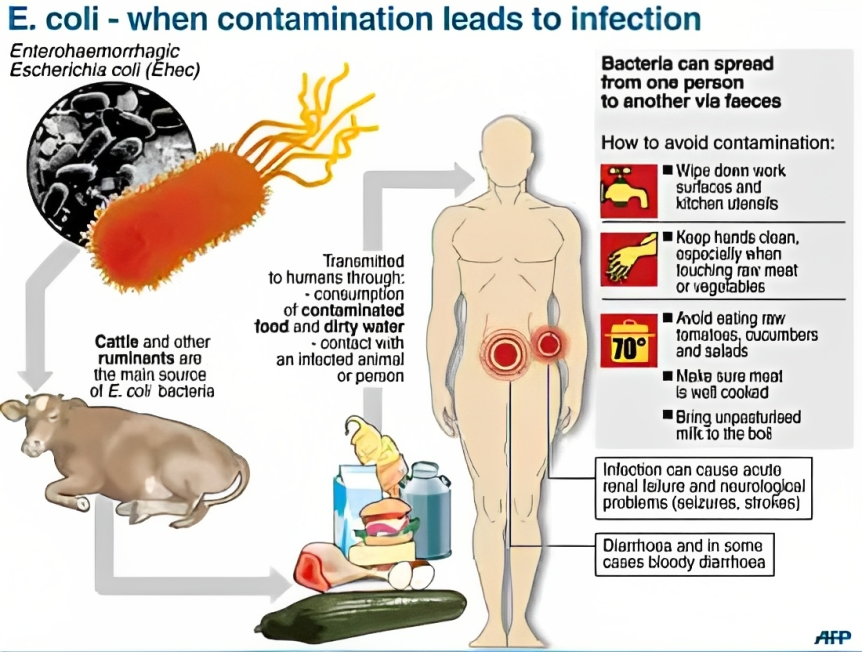 E. coli outbreak in Burney, California (USA)