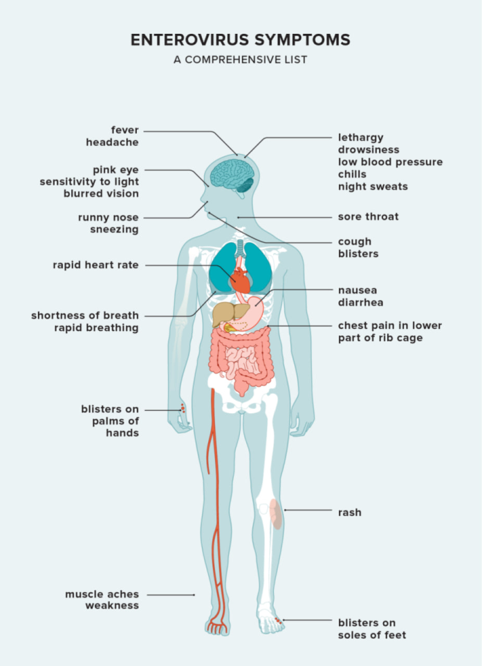 ENTEROVIRUS INFECTIONS