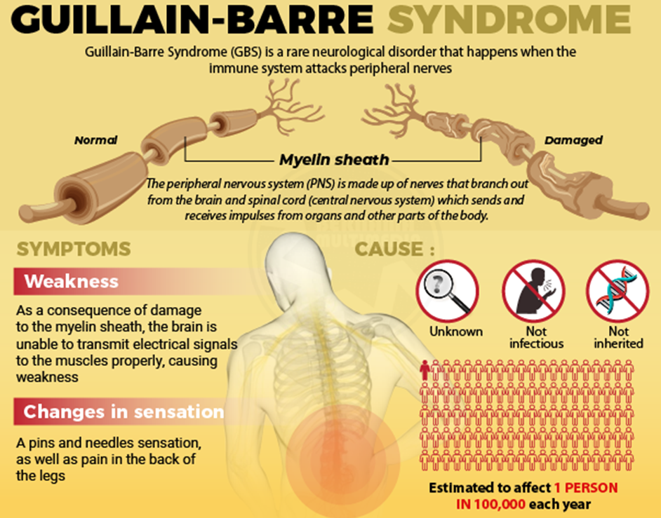 GUILLAIN-BARRE SYNDROME