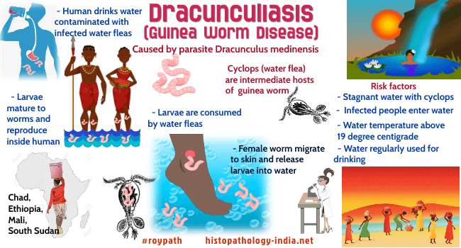 Last Mile in Eradicating Guinea Worm Disease UPSC