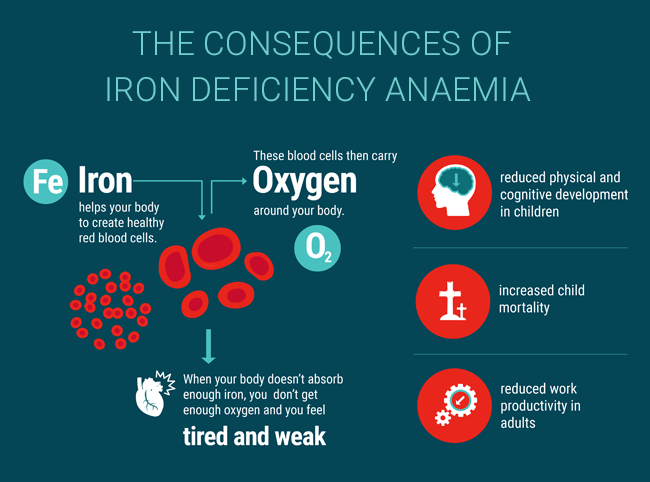 INDIA’S ANAEMIA POLICY - UPSC Current Affairs - IAS GYAN