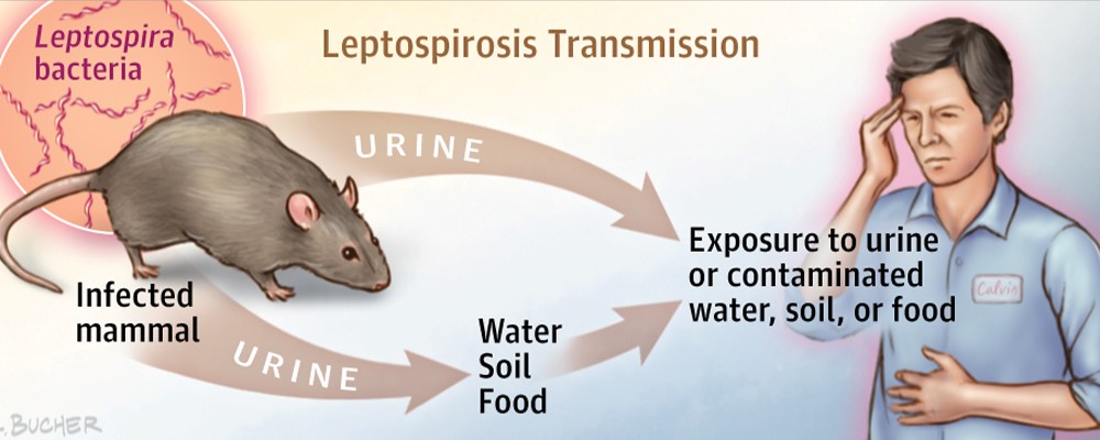 Лептоспироз у человека