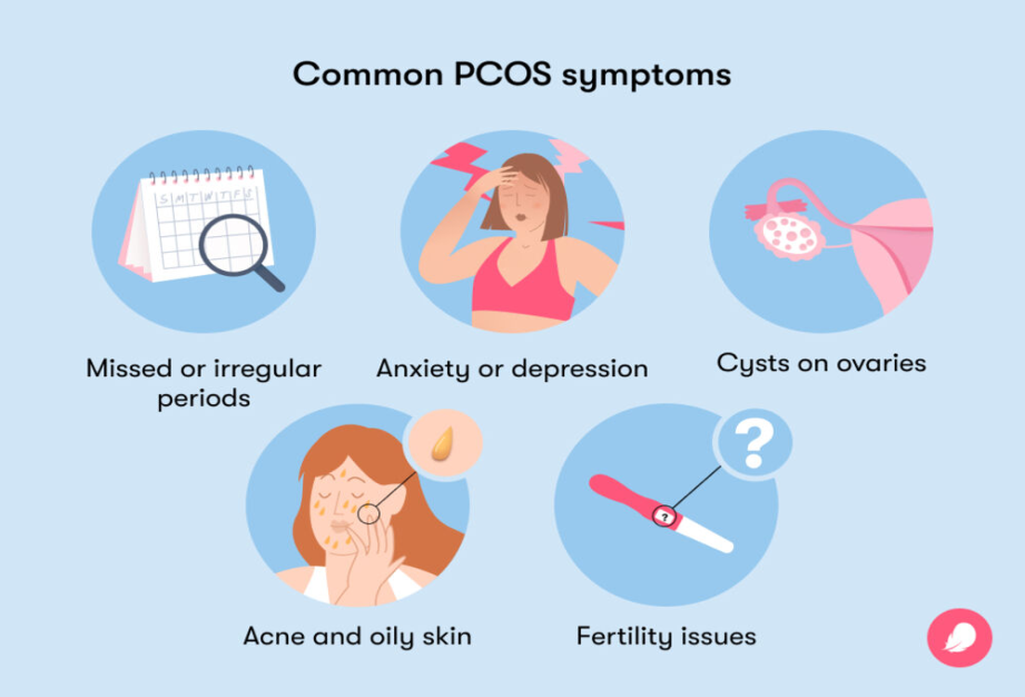 Polycystic Ovary Syndrome (PCOS) among young girls in India UPSC