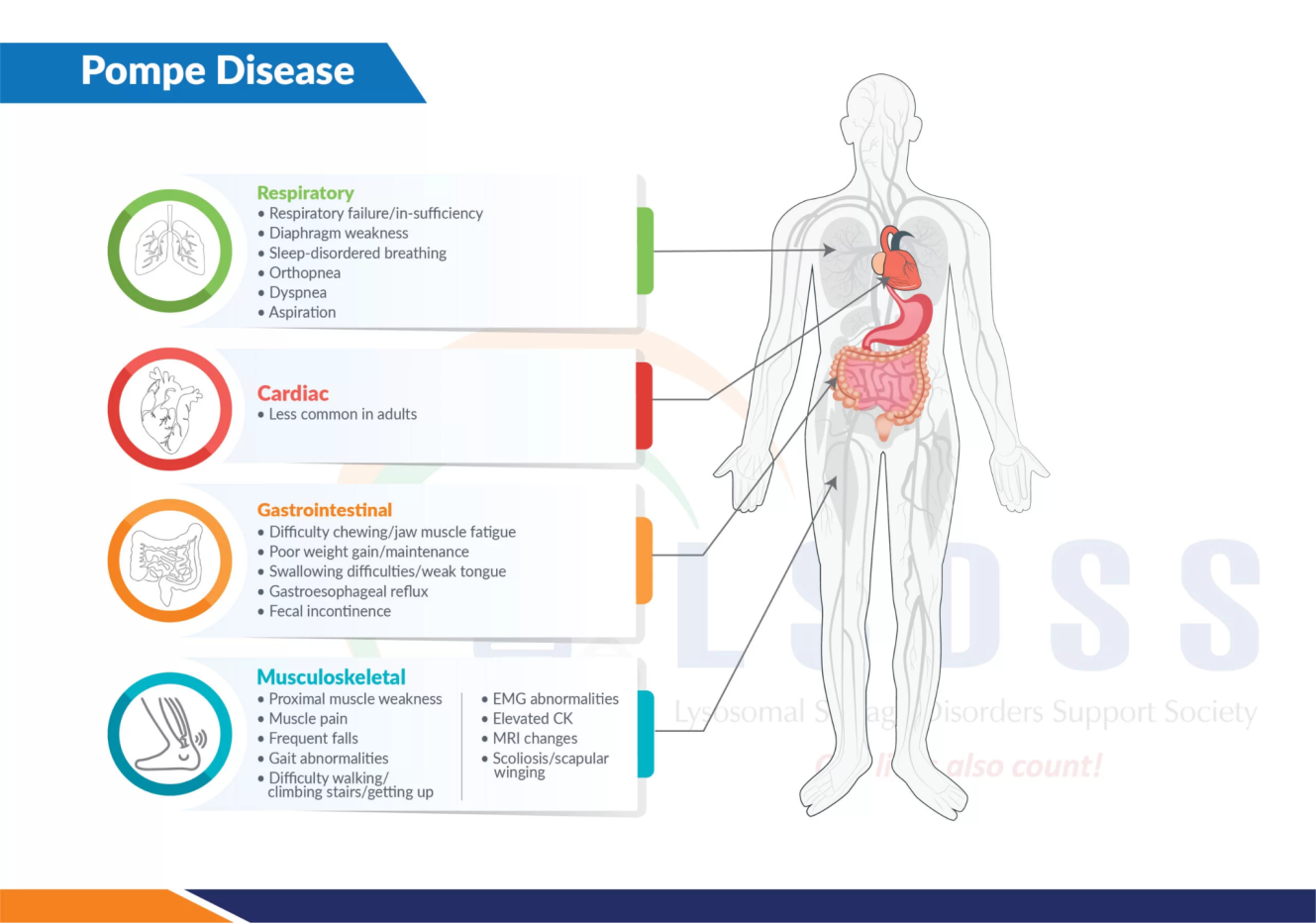 Pompe disease causing progressive muscle weakness UPSC