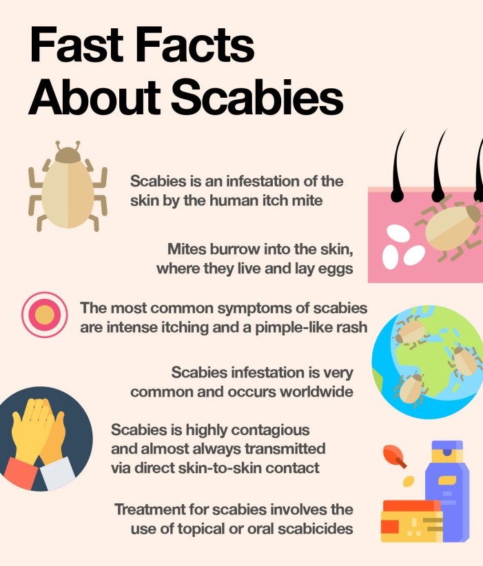 Scabies Outbreak In Malawi UPSC   SCABIES 2 