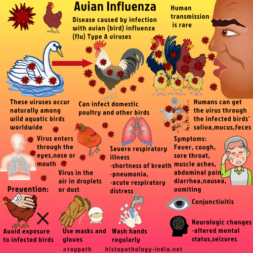 H5N1 avian influenza