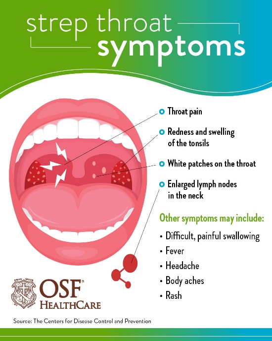 top-10-ways-to-overcome-a-sore-throat-drjockers